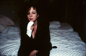 Lot 4176, Auction  127, Goldin, Nan, Self-portrait after finger operation, Berlin
